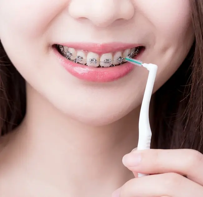 치간칫솔은 세련된 구강 관리의 새로운 경험을 창조합니다